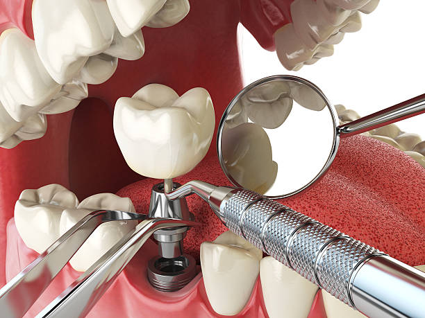 Best Emergency Dentist for Special Needs Patients in South Whitley, IN